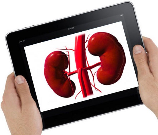 Un riñón por un iPad 2… Literalmente